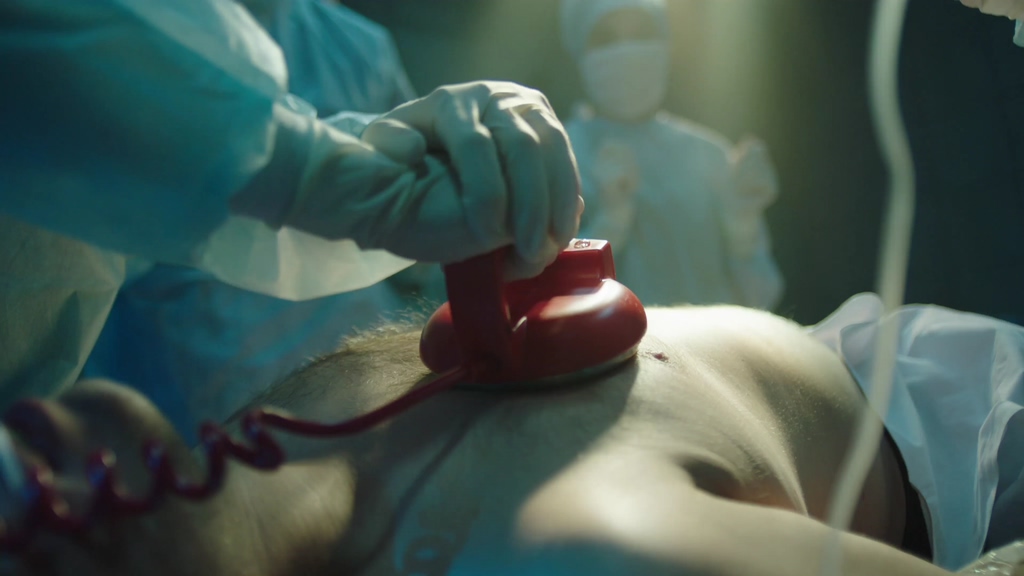 4K手术室里的心脏复苏视频素材