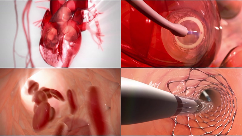 3D心血管医疗动画视频素材